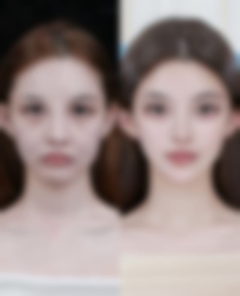 怎么除皱更安心