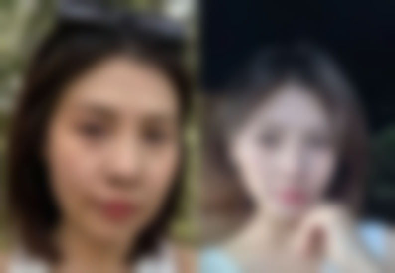 打完瘦脸针第二天喝酒了会怎么样