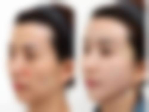 【朴根范医生技术特点】