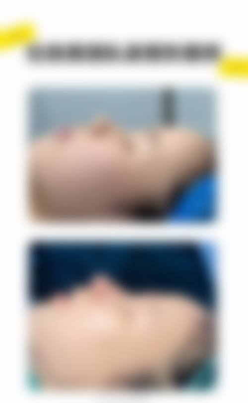 【湖南张家界维纳斯整形参考价格表：】