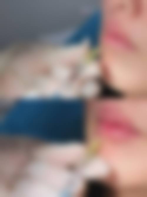 【历下熙美人整形医院特色项目：】