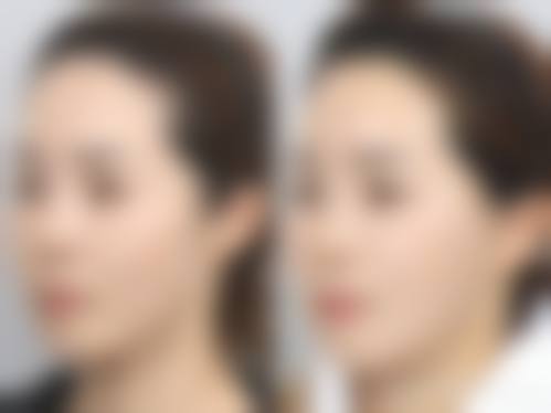 【朴根范医生怎么预约挂号?】