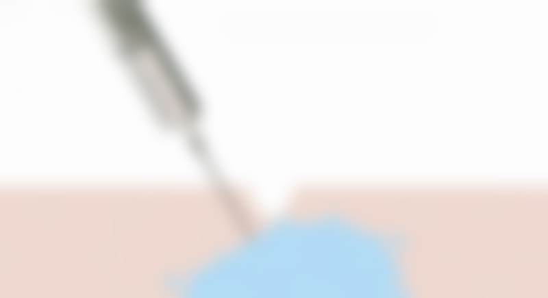 【曾江医生技术特点】