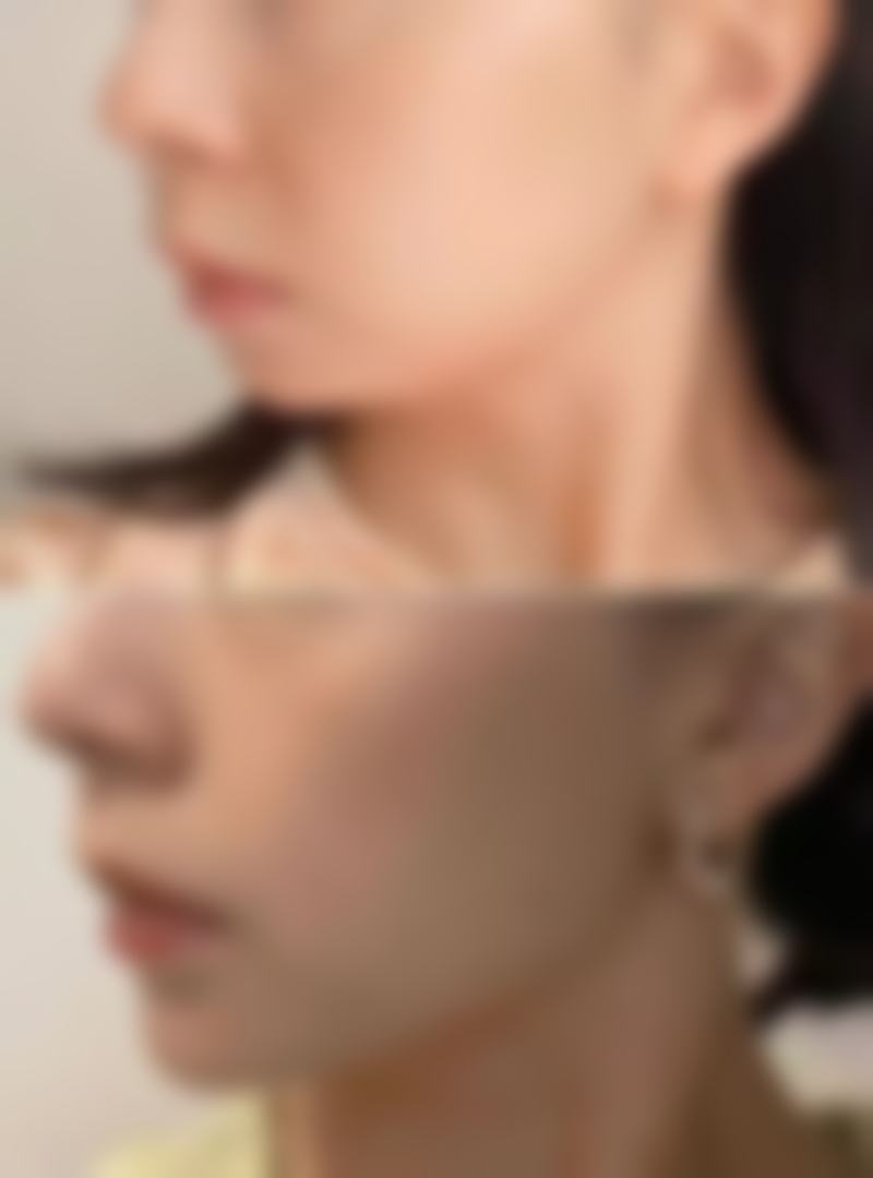 【历下熙美人整形医院是正规的吗?】