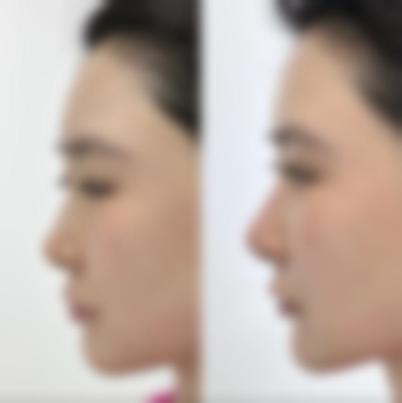 【周晶蓉医生怎么预约挂号？】