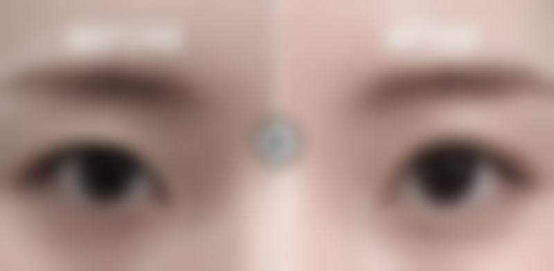 【湖南张家界维纳斯整形怎么预约挂号?】