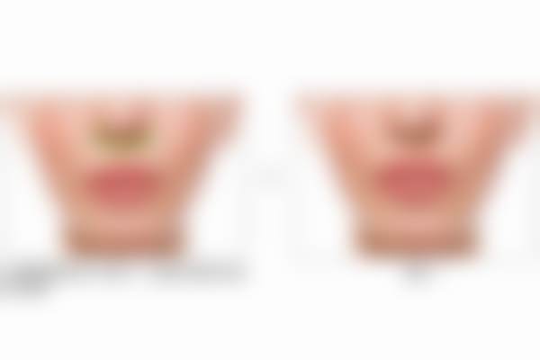 北京蕾士悦容医美开展该项目的实例/口碑