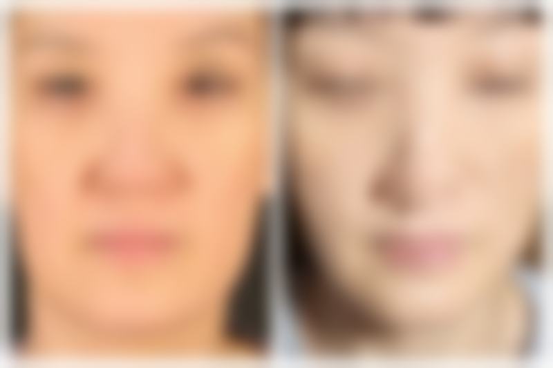 美容院可以打瘦腿针吗