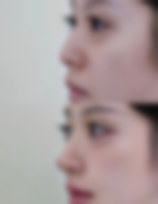 【何俊峰医生口碑怎么样？】