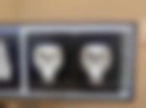 为什么白头发越长越多？你以为是老了，提醒：或是缺乏 2 种营养素