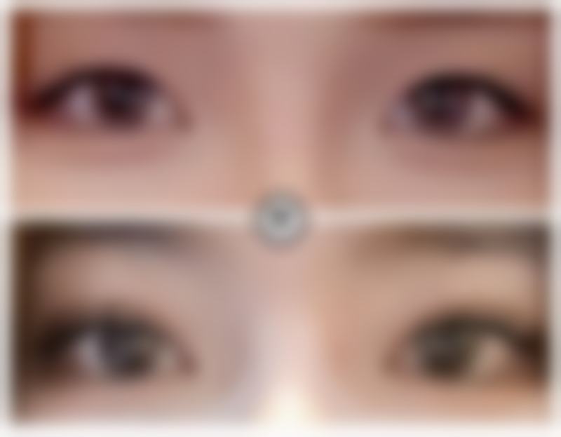 除皱针的价格一般是多少