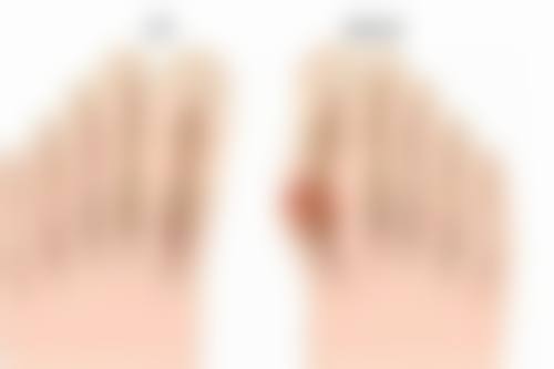 成效观察与复诊注意事项