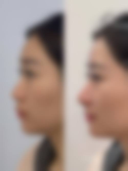 【兴义熊文学医疗美容诊所参考价格表:】