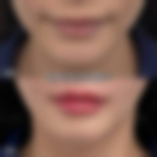 【兴义熊文学医疗美容诊所患者口碑评价:】