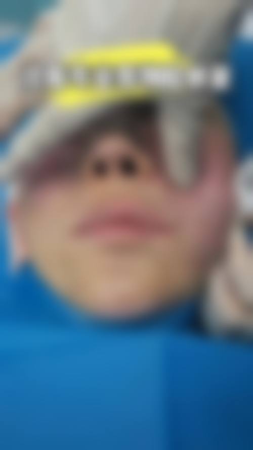 【兴义熊文学医疗美容诊所特色项目:】