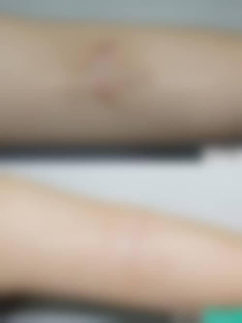 【雅安斯卡娣美医疗美容门诊部是正规的吗?】