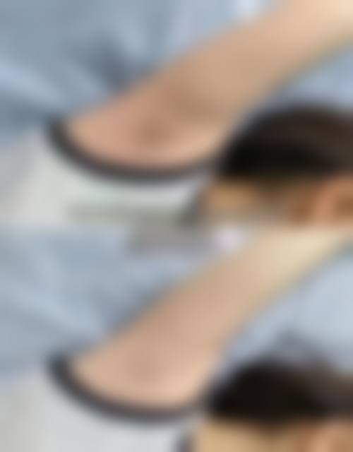 【赵克亮医生擅长项目】