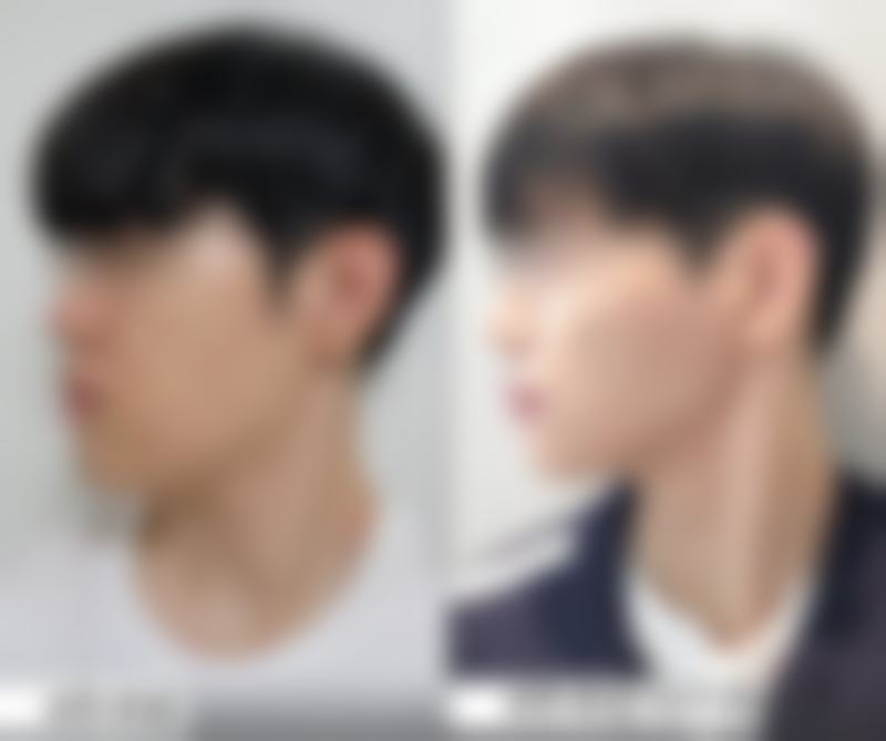 【徐义杰医生技术特点】