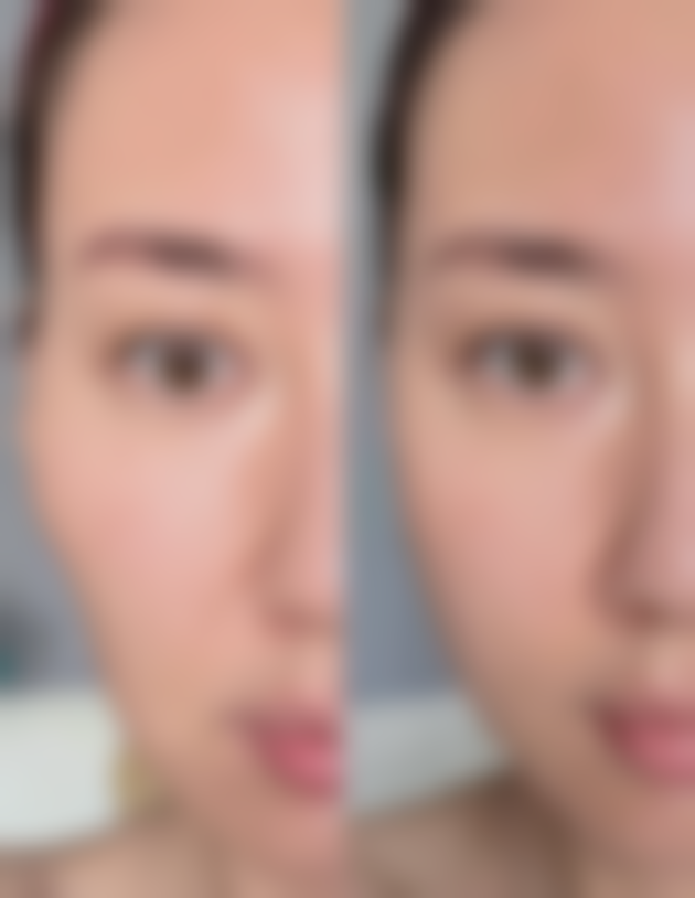 种植头发能生长吗?真的可以自然生长吗?