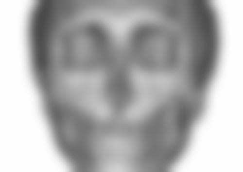 瘦脸针打完一针以后不打会怎样