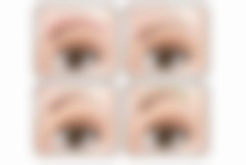 瘦脸针的相关问题