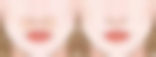 激光除皱真的有效吗