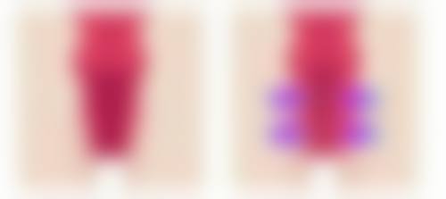 刚打完瘦脸针可以吃东西吗