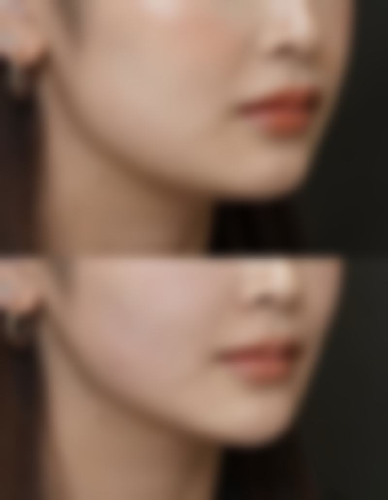 刚打完瘦脸针是不是不能吃东西