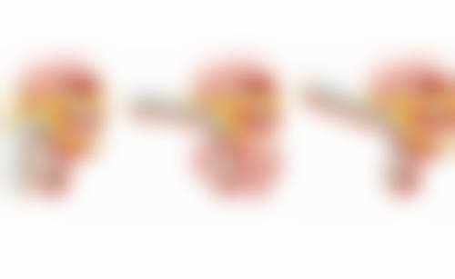 胶原蛋白填充太阳穴