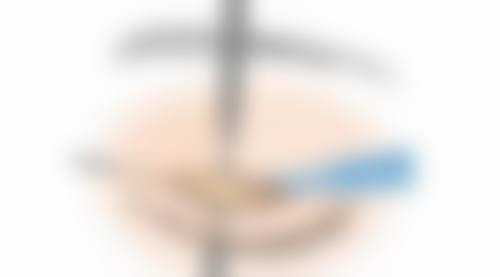 除皱针哪个牌子成效好