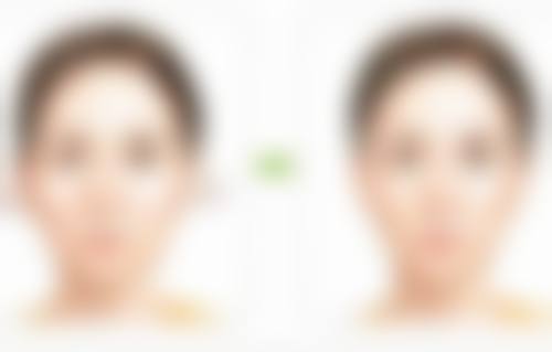 打完瘦脸针多久可以打 HPV 疫苗