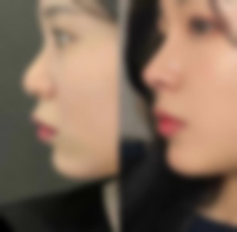 【解放军第309医院整形美容烧伤修复中 心是正规的吗?】