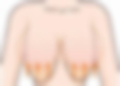 头顶脱头发重度是什么原因引起的