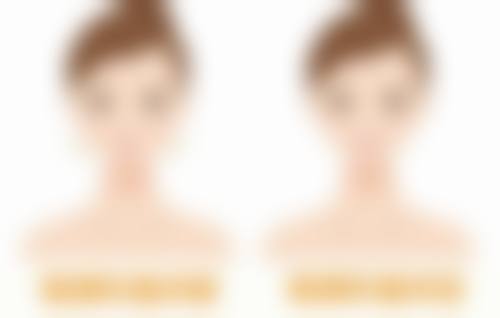 自身脂肪丰胸费用多少