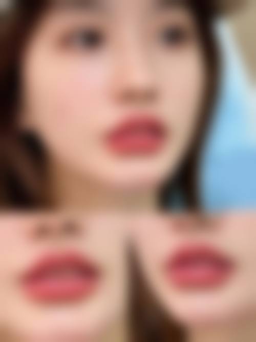 【皖南医学校弋矶山医院整形外科怎么预约挂号?】