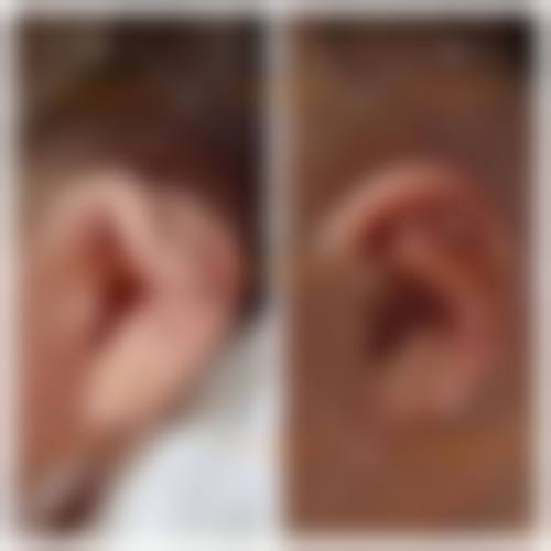 【赣州臻美荟再生美医院参考价格表：】