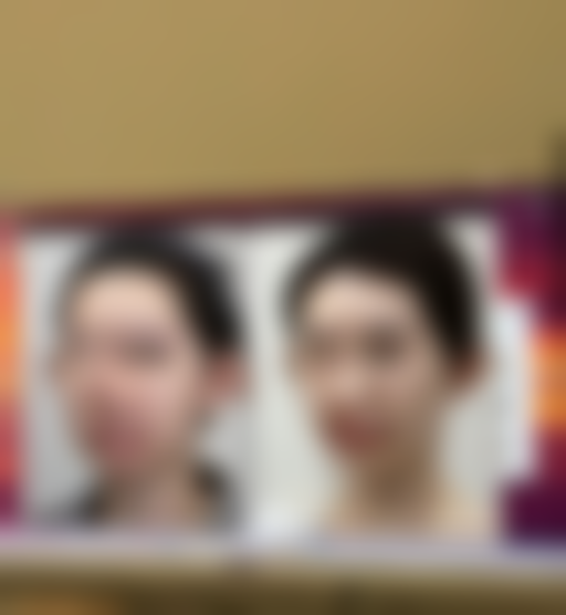 头顶头发稀少还能修复吗