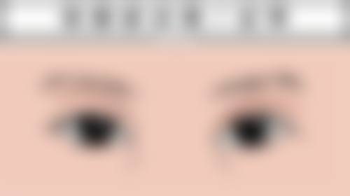 胖的时候打瘦脸针好，还是瘦的时候打