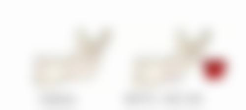 下颌角整形有哪些风险？