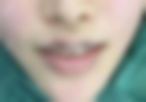 【宁波媞莎美整形医院诊疗设备：】