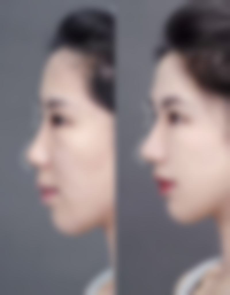 岳阳汨罗逸韩整形美容医院是一家正规的整形美容医院。它在医疗美容外科的基础上不断升级发展，有着完善的医疗体系和规范的操作流程。医院的医师团队多数来自日本、韩国等地，还有国内的博士及博士生导师，他们理论基础扎实，临床经验多，这也从侧面反映了医院的正规性和专精性。