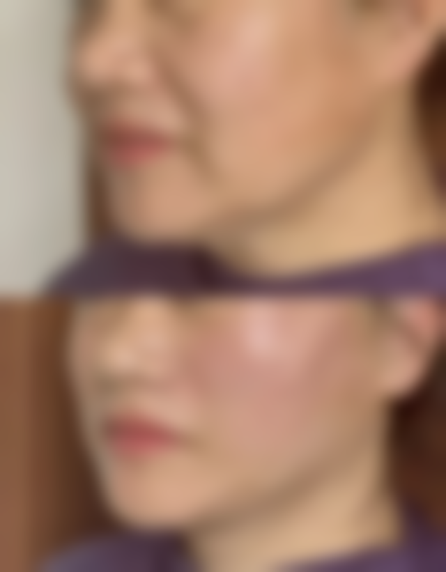 以下是部分项目的价格区间（元起），价格仅供参考，实际以到院面诊为准。