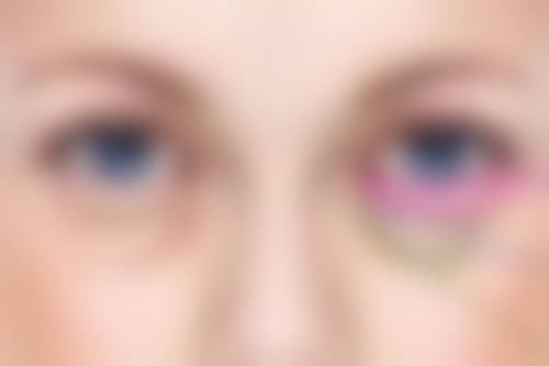 阴道壁膨出可以做骨盆修复吗