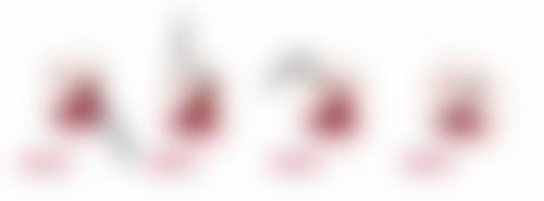 自体脂肪丰臀的存活率