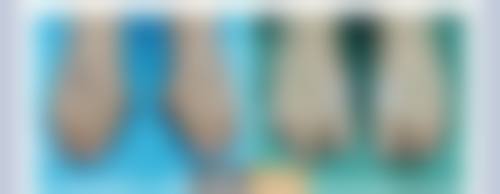 【石家庄市中医院怎么预约挂号?】