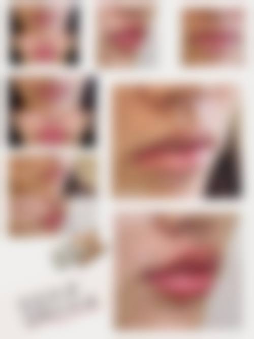 【河北廊坊零皙医疗美容诊所特色项目：】