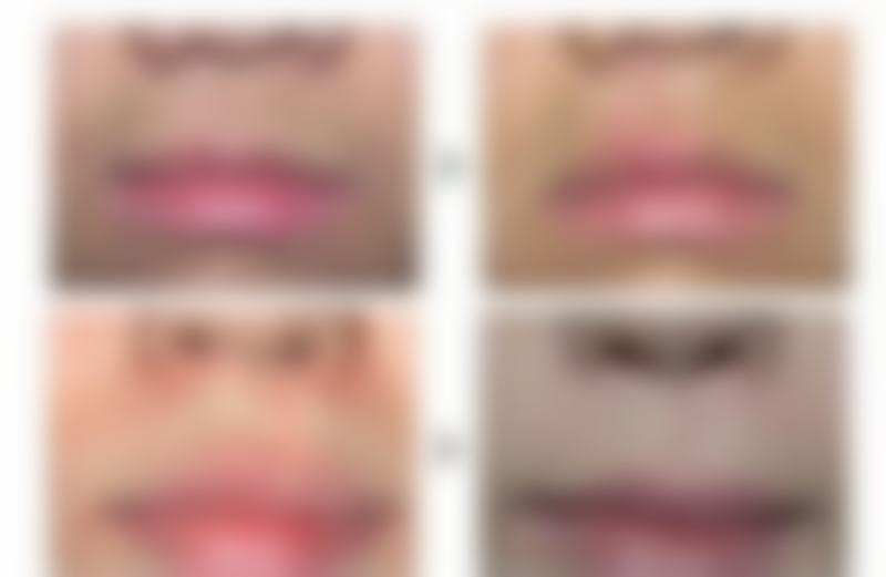 【卢忠询医生执业信息】