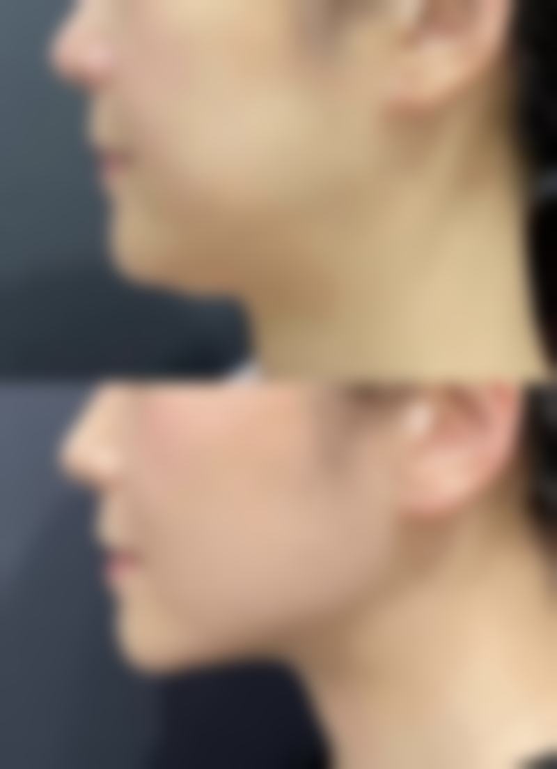 女的老了会有啥变化