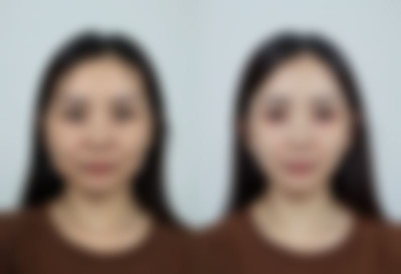 【郑州臻爱容颜医疗美容门诊部是正规的吗?】