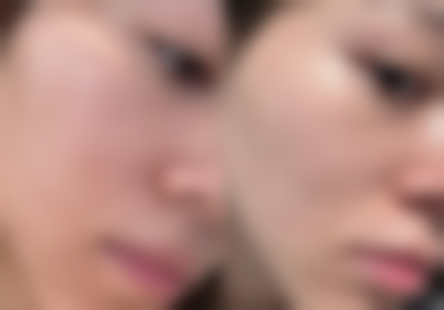 【烟台华美美容整形医院诊疗设备:】